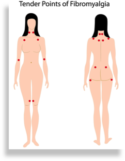 Fibromyalgia.Relief.houston
