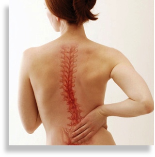 Scoliosis.Relief.houston